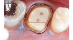 肉眼で見た場合