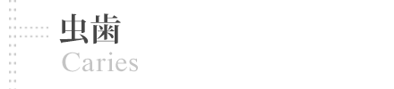 虫歯治療 | cavity