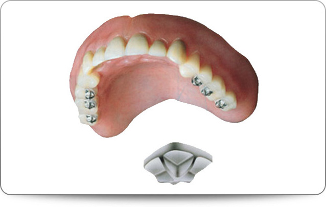 何でも噛み切りやすい入れ歯