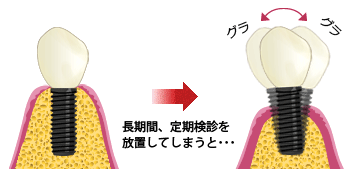 長時間定期検診を放置してしまうと