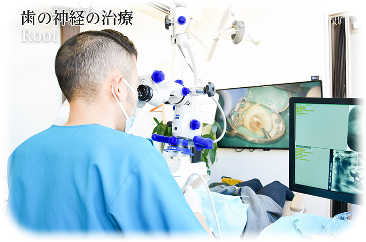 歯の神経の治療 | Root