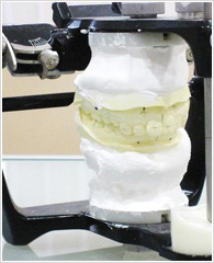 咬み合わせチェック