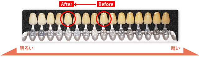 ビフォアー アフター