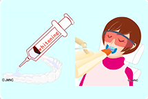 自宅と医院でホワイトニング