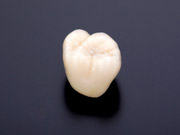 審美セラミック治療