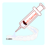 ホワイトニング治療